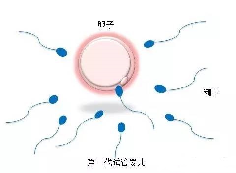 液氮库